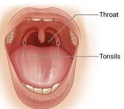 Throat Swab C/S 